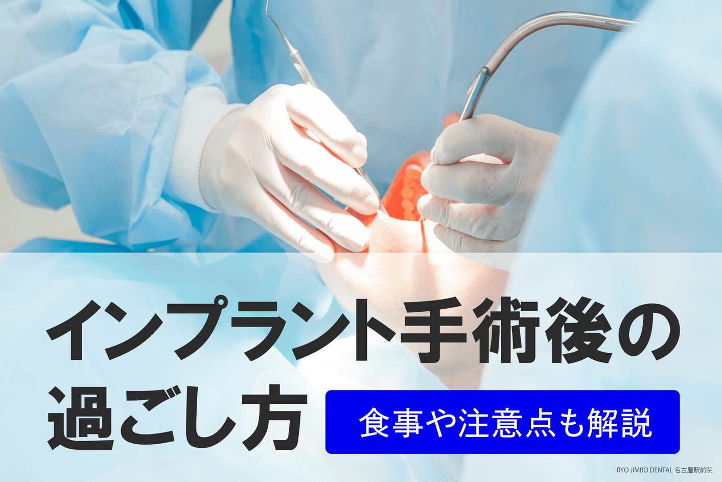 インプラント手術後の過ごし方｜適切な食事や注意点を歯科医師が解説